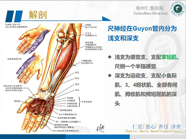 腕尺管綜合征