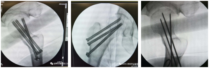 徐州仁慈醫(yī)院骨科機(jī)器人