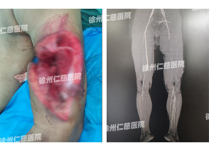 徐州仁慈醫(yī)院臂叢神經