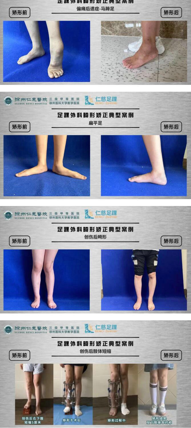 徐州仁慈醫(yī)院