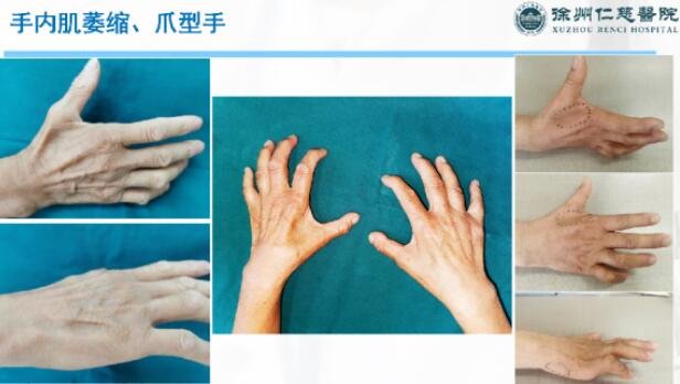 徐州仁慈醫(yī)院