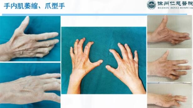 徐州仁慈醫(yī)院